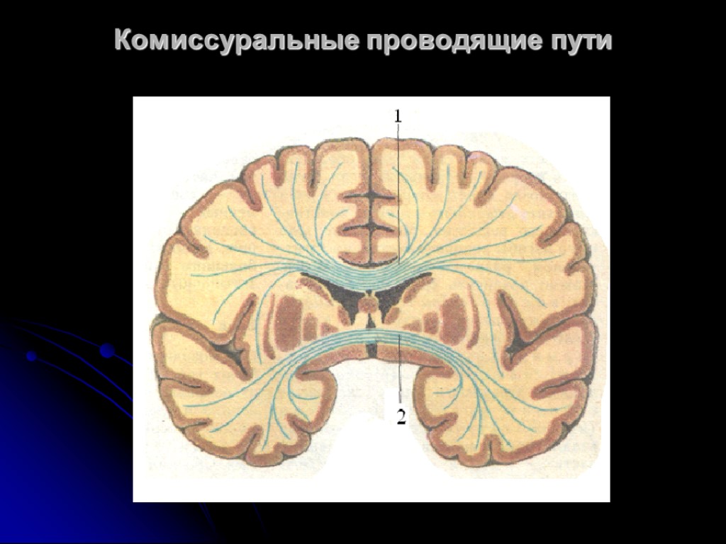 Проводящие пути головного и спинного мозга картинки